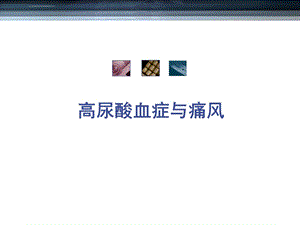 高尿酸血症与痛风ppt课件.ppt