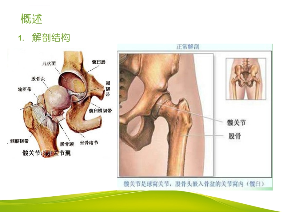 髋关节术后护理及康复训练ppt课件.ppt_第3页