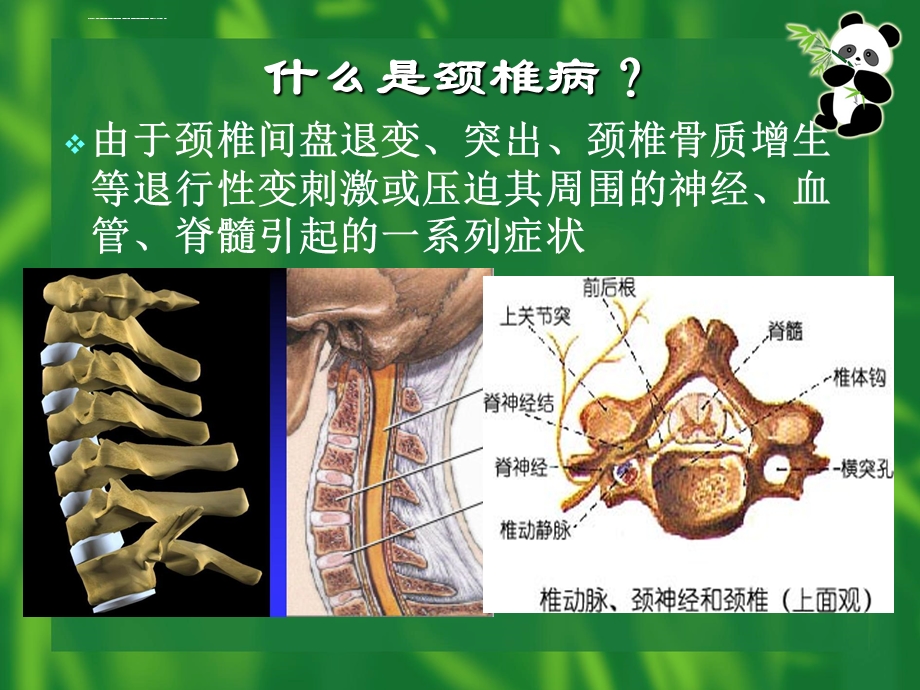 颈椎病的原理和各种治疗方法ppt课件.ppt_第3页