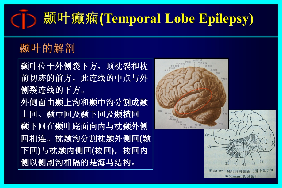 颞叶癫痫ppt课件.ppt_第3页