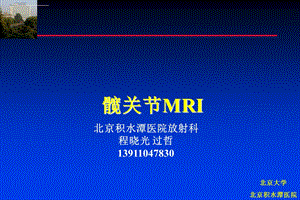 髋关节的MRI程晓光ppt课件.ppt