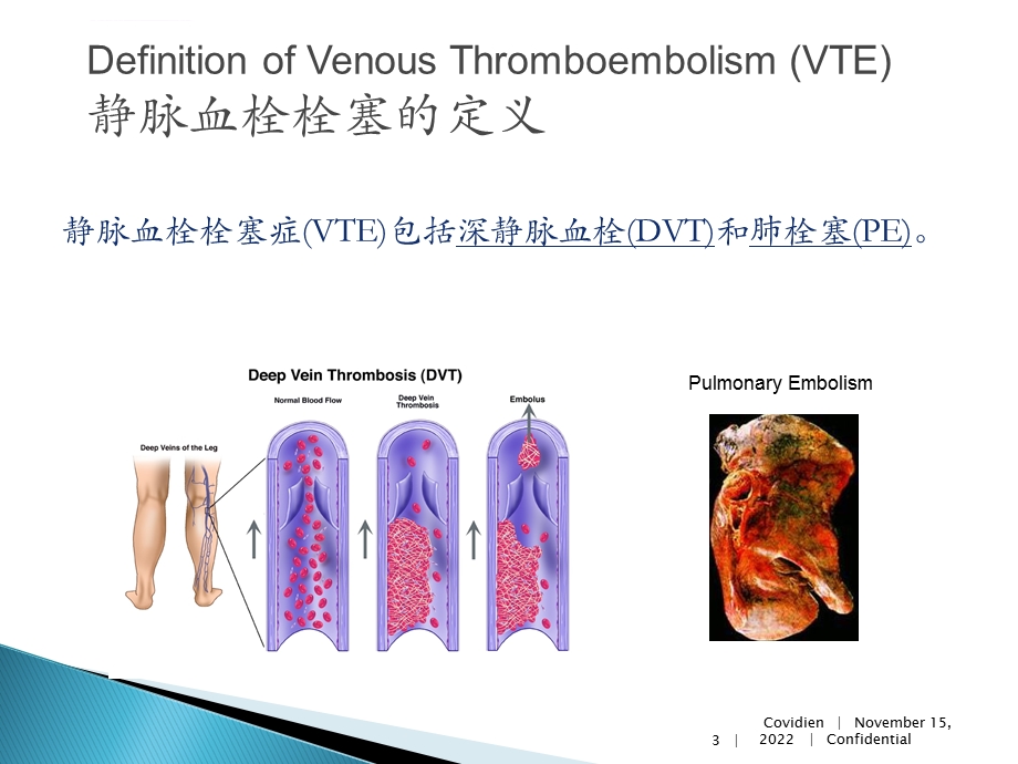 静脉血栓栓塞ppt课件.ppt_第3页