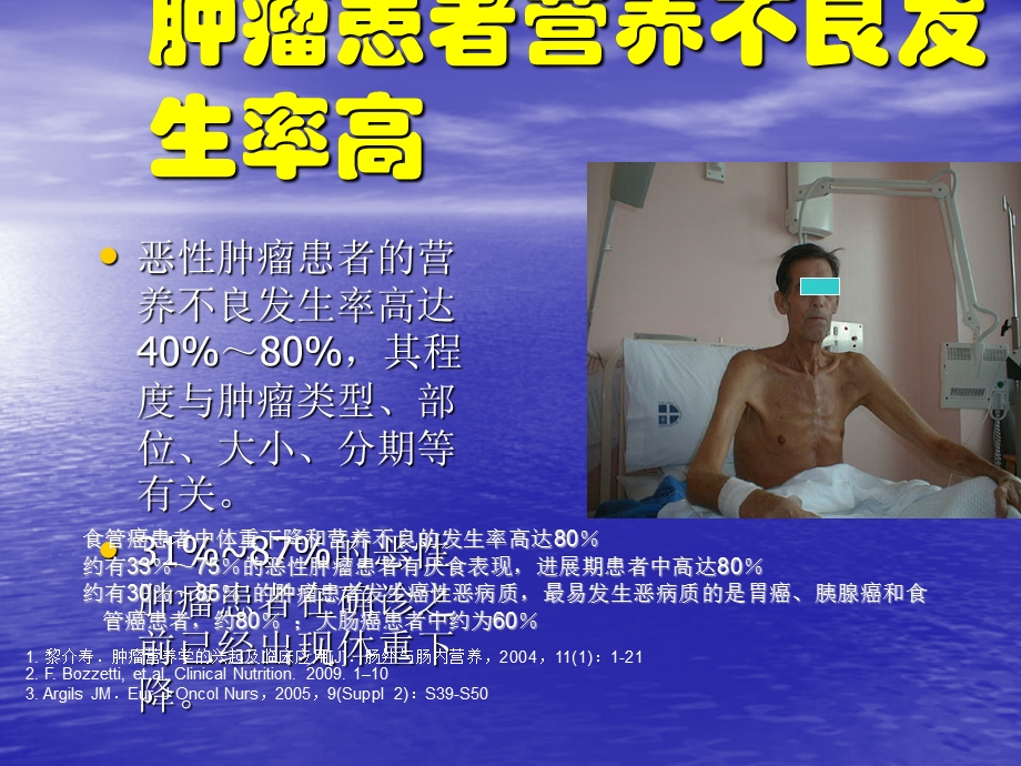 肿瘤病人的营养治疗ppt课件.pptx_第3页