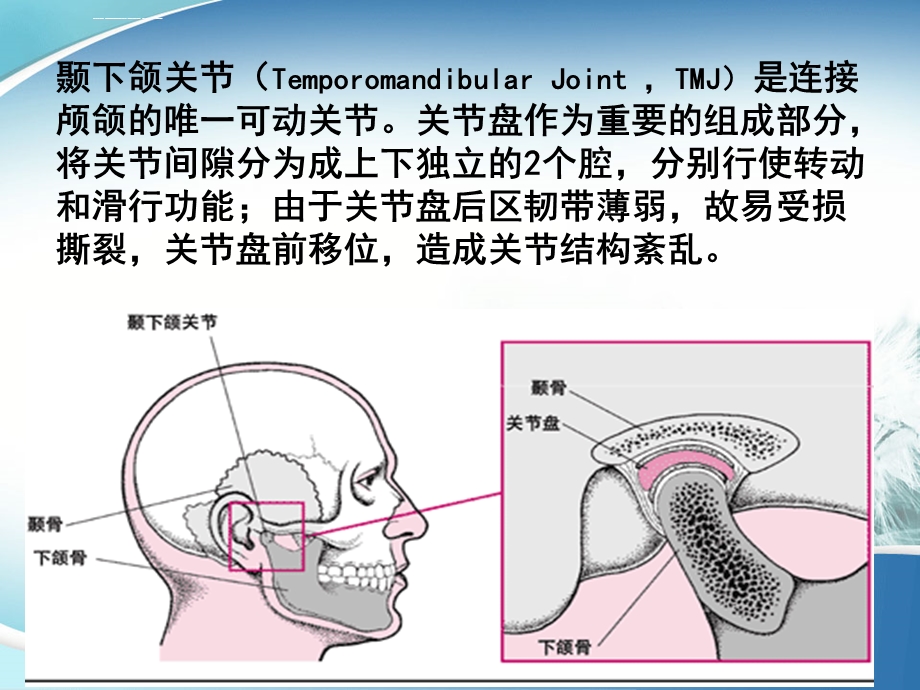 颞颌关节手术简介ppt课件.ppt_第2页