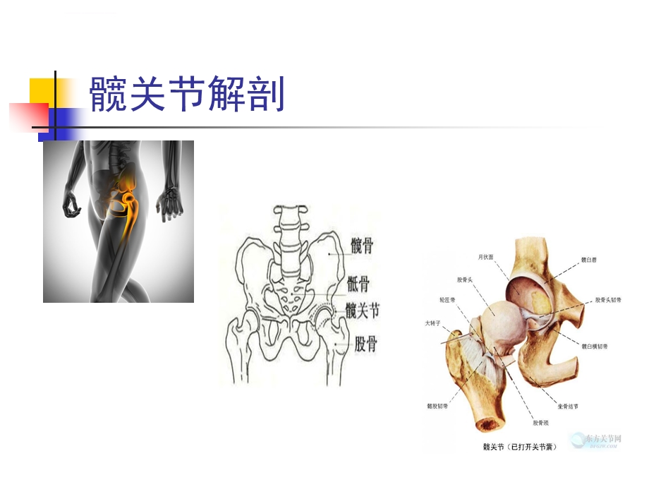 髋关节置换护理查房ppt课件.ppt_第3页