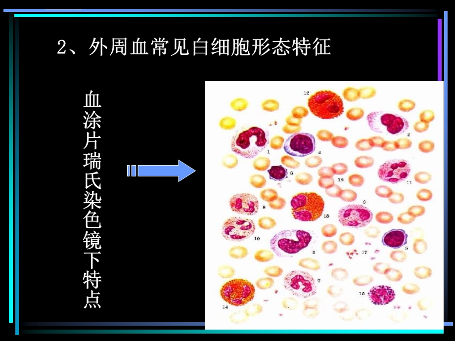 血液白细胞检验的形态特点ppt课件.ppt_第2页