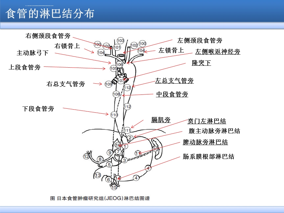 食管癌淋巴结三野清扫ppt课件.ppt_第2页