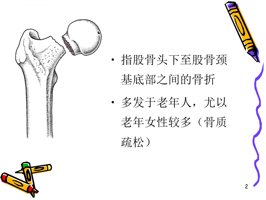 股骨颈骨折的护理PPT课件.ppt_第2页