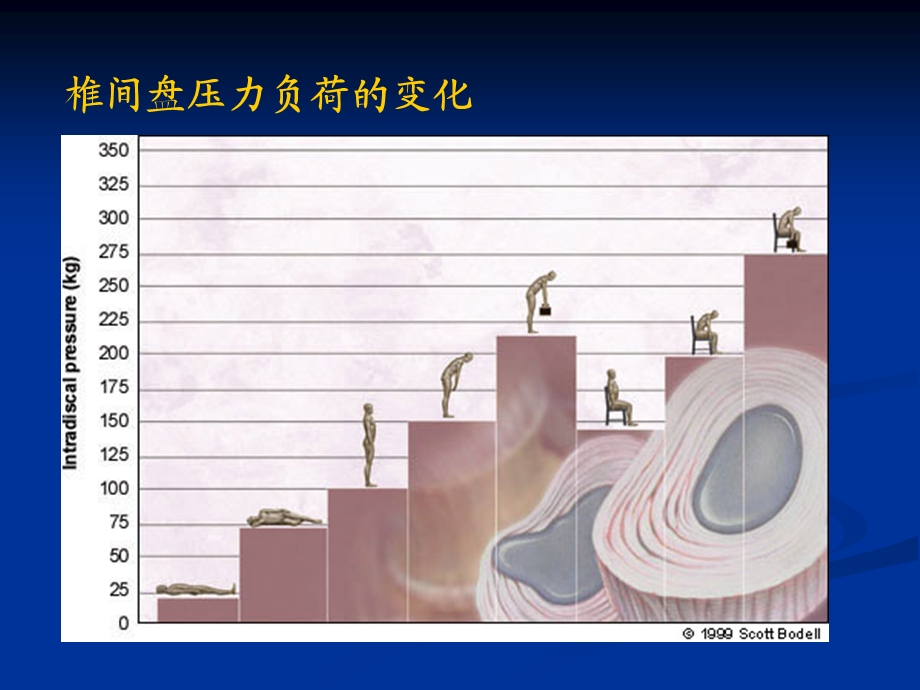 腰椎键盘突出症颈椎病ppt课件.ppt_第3页