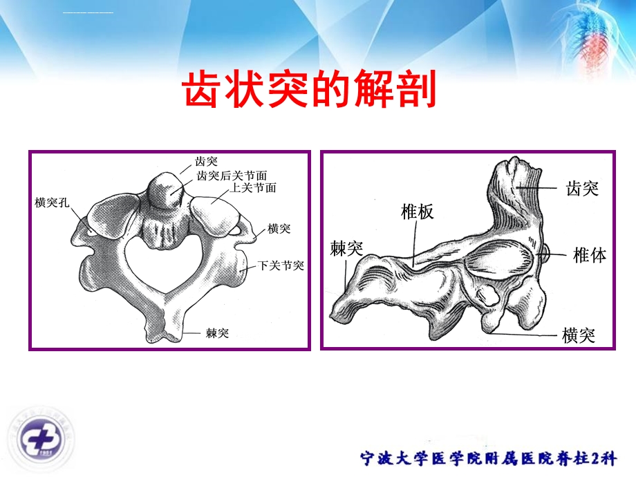 齿状突骨折ppt课件.ppt_第3页