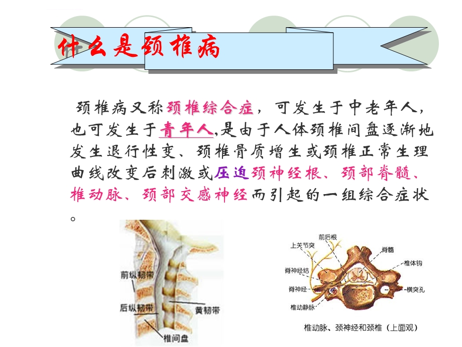 颈椎病术后的护理ppt课件.ppt_第2页