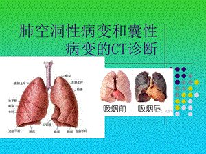 肺空洞性病变和囊性病变的CT诊断ppt幻灯片课件.ppt