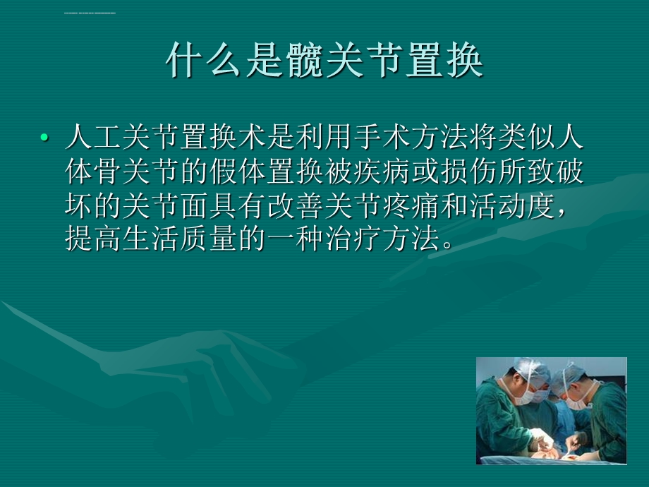 髋关节置换术围手术期的护理ppt课件.ppt_第2页