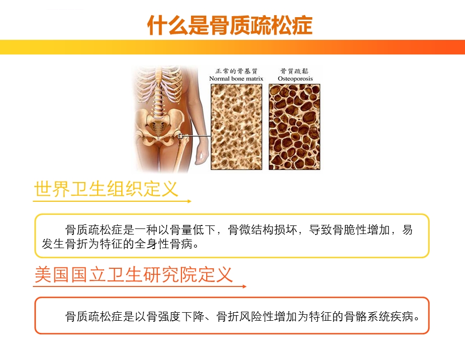 骨质疏松健康讲座ppt课件.ppt_第3页