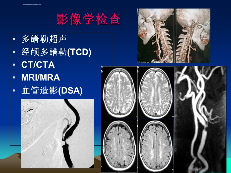 颈动脉狭窄介入治疗ppt课件.ppt_第3页