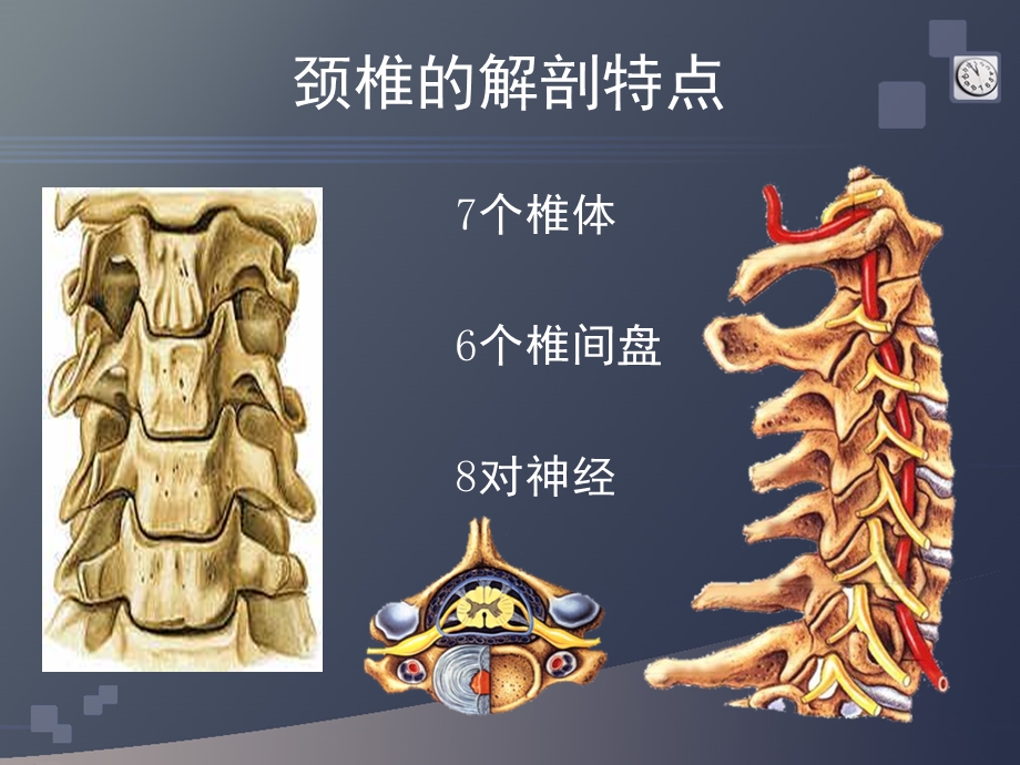 颈椎病的CT诊断ppt课件.ppt_第3页