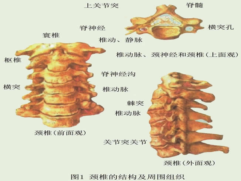 颈椎X线诊断ppt课件.ppt_第3页