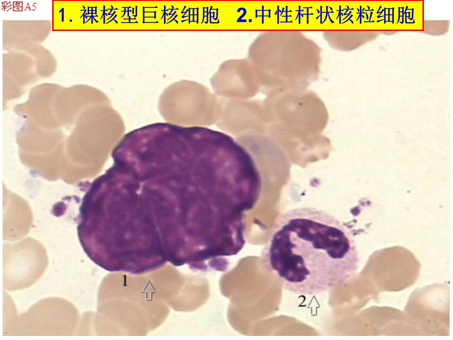 骨髓细胞图谱ppt课件.ppt_第3页