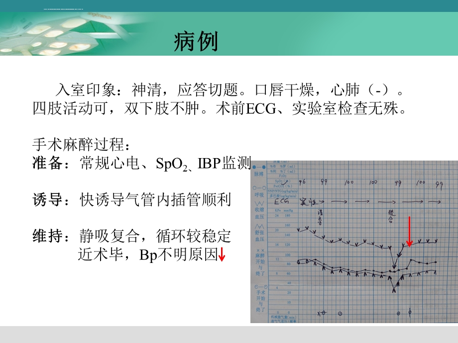 颅内动脉瘤介入栓塞术的麻醉管理ppt课件.ppt_第3页