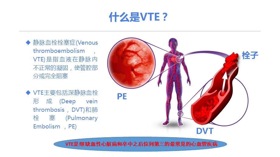 静脉血栓栓塞症(VTE)诊断和治疗ppt课件.pptx_第3页