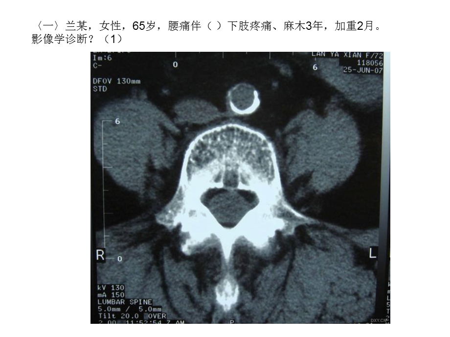 丁香园影像阅片ppt课件.ppt_第3页