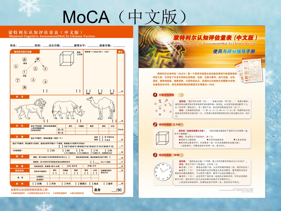 MoCA量表北京版测试用表ppt课件.ppt_第1页