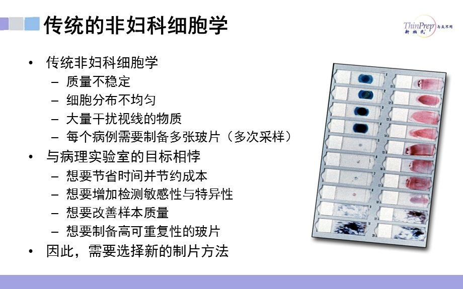 TCT在非妇科中的应用ppt课件.ppt_第2页