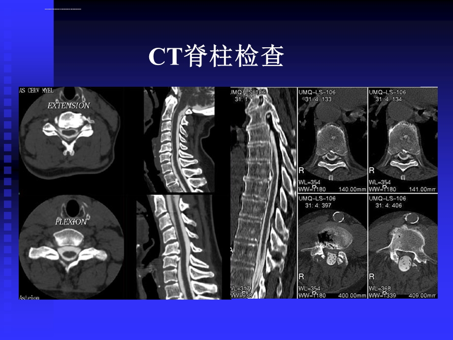 《脊柱肿瘤》ppt课件.ppt_第2页