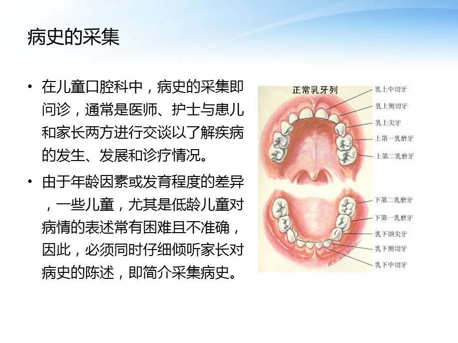儿童口腔疾病病史的采集、口腔检查及治疗计划的制定ppt课件.ppt_第2页