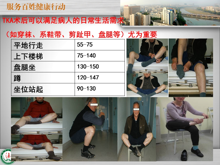 全膝关节置换术后影像学评估ppt课件.ppt_第2页