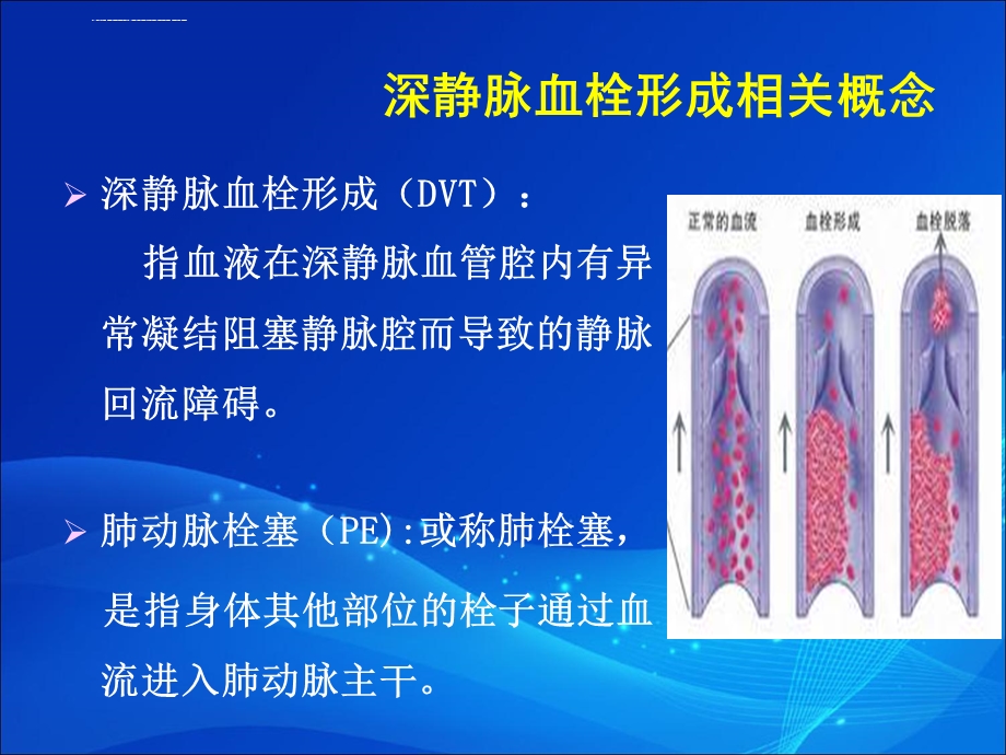 下肢深静脉血栓形成的防治指南ppt课件.ppt_第3页