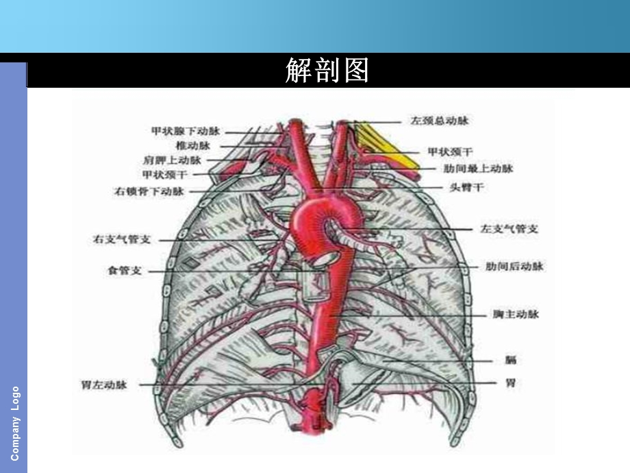 主动脉夹层护理查房1ppt课件.ppt_第3页