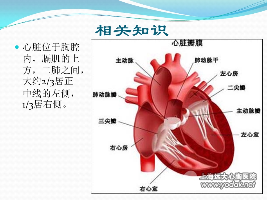 二尖瓣置换术手术配合ppt课件.pptx_第3页