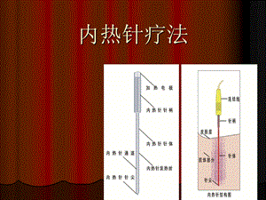 内热针疗法精品ppt课件.ppt