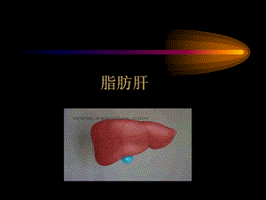 健康管理师 脂肪肝ppt课件.ppt