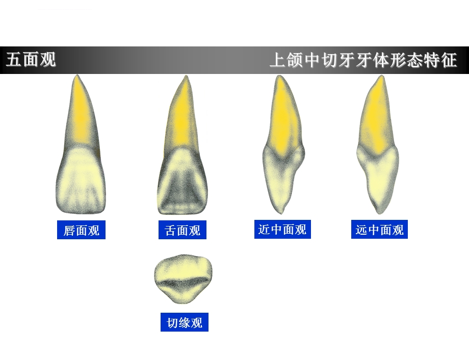 上颌中切牙形态特征简述ppt课件.ppt_第3页