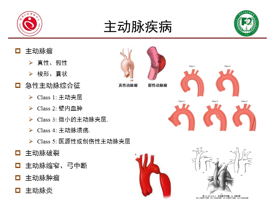 主动脉围术期血压管理ppt课件.pptx_第2页