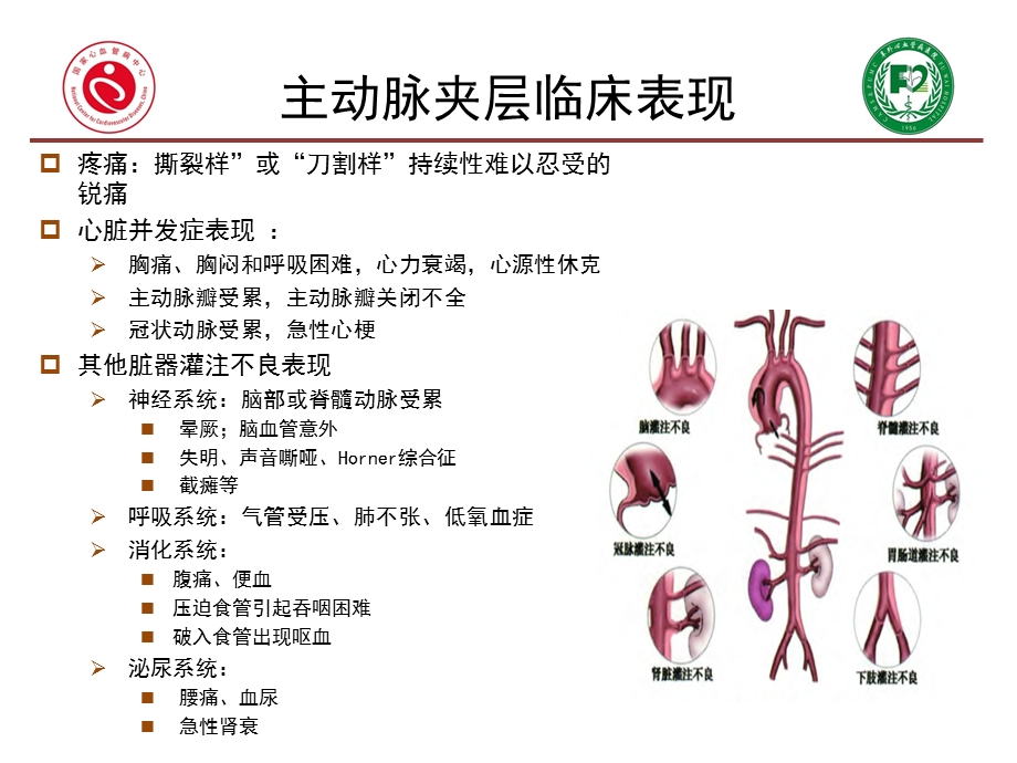 主动脉围术期血压管理ppt课件.pptx_第3页