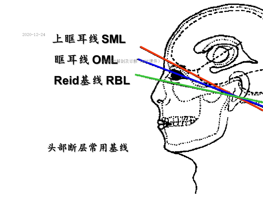 头颅CT解剖及诊断(PPT课件).ppt_第3页