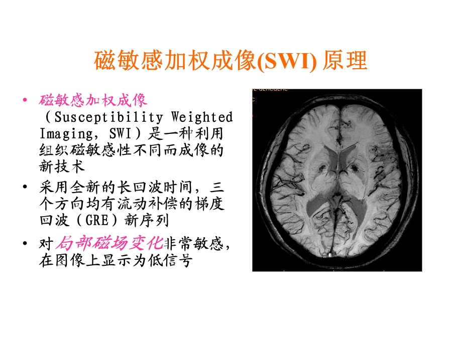 磁敏感加权成像(SWI)原理及临床应用课件.pptx_第3页