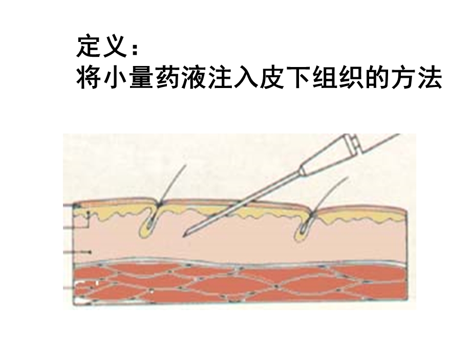 皮下注射技术操作流程实用版课件.ppt_第2页