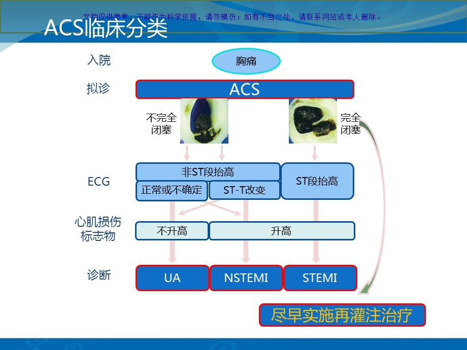 急性心肌梗死汇总课件.ppt_第2页