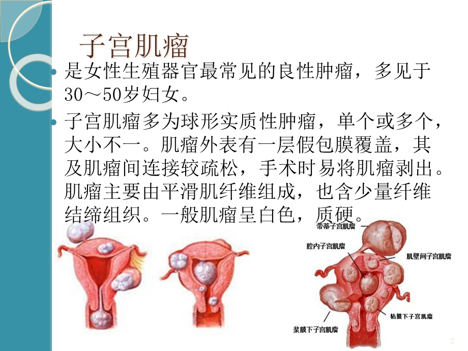 妇科常见疾病的临床特点课件.ppt_第2页