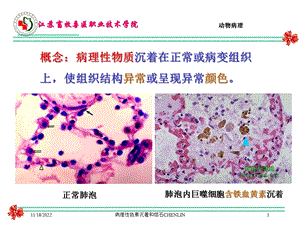 病理性色素沉着和结石CHENLIN培训课件.ppt