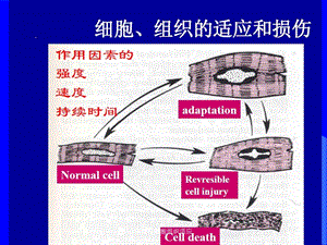 病理学细胞组织适应课件.ppt