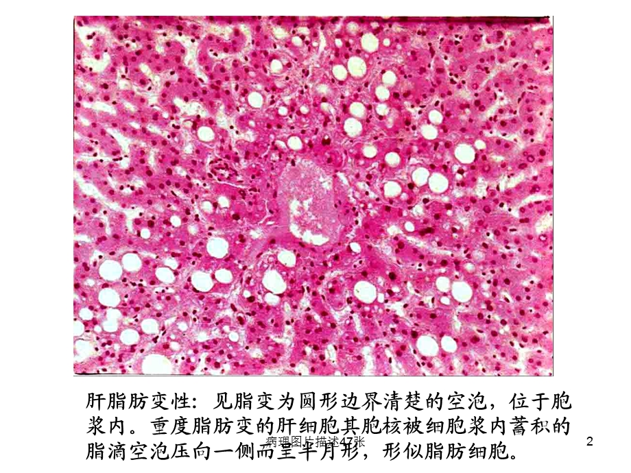 病理图片描述47张课件.ppt_第2页