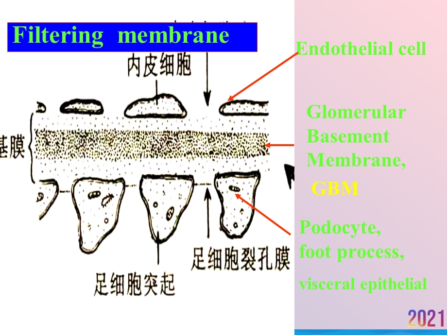 病理十二章泌尿系统疾病课件.ppt_第3页