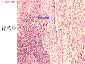 病理切片考试最完整培训课件.ppt