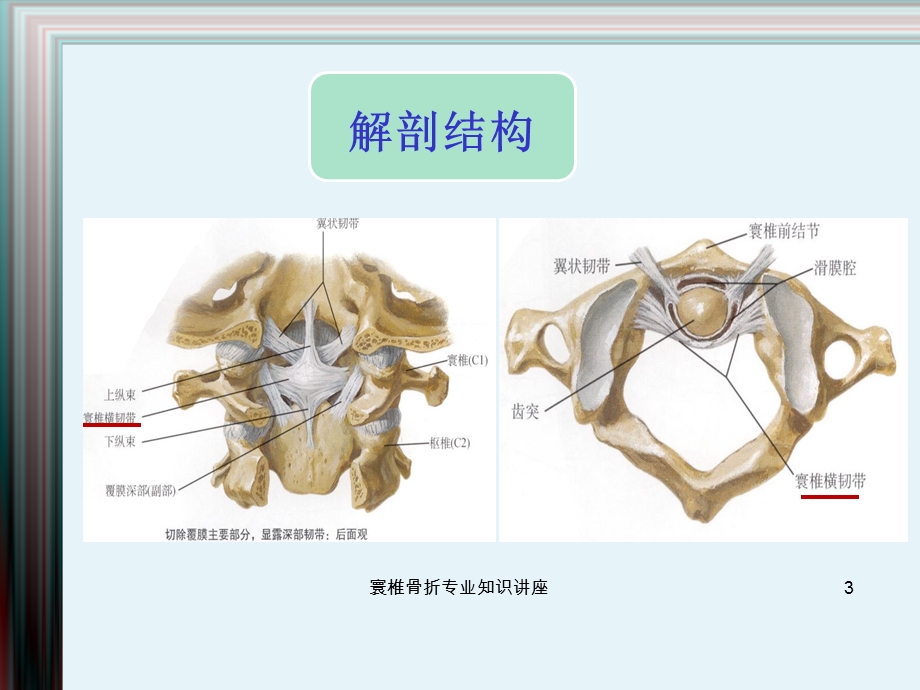 寰椎骨折专业知识讲座培训课件.ppt_第3页