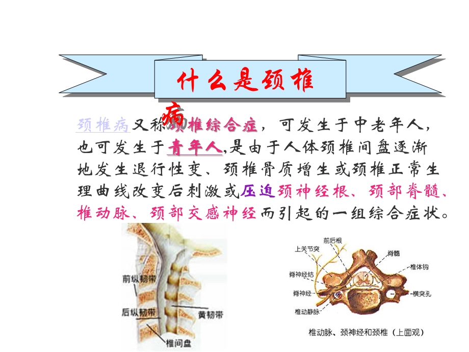 白领颈椎病的防治课件.ppt_第2页